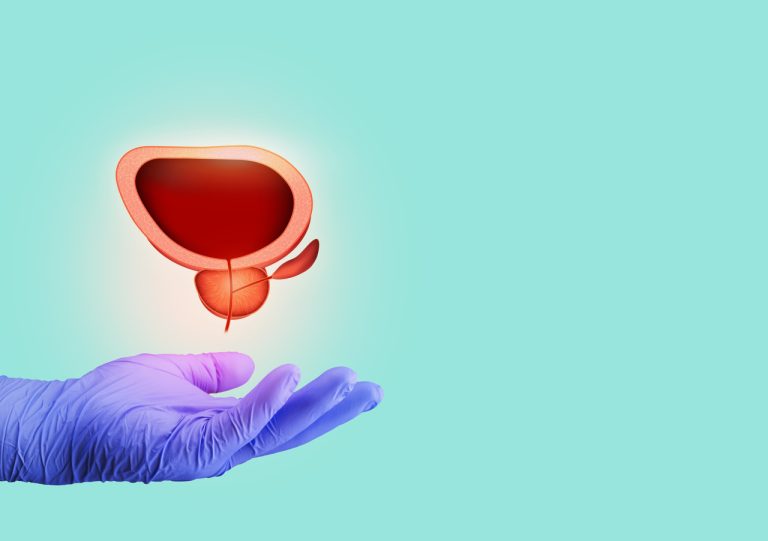 Dr. Marco Túlio Cruvinel, urologista em Goiânia, utiliza técnica HoLEP no tratamento definitivo do aumento da próstata
