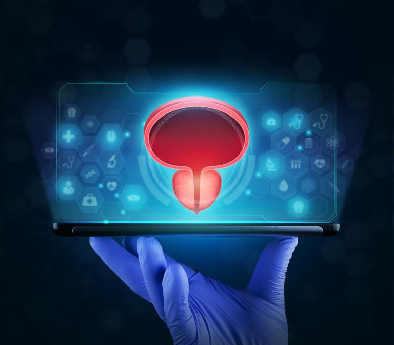 Cirurgia a laser com Holep transforma o cenário do tratamento da próstata no Brasil