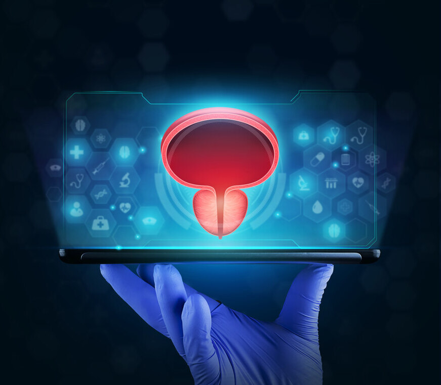 1- Qual a melhor opção de cirurgia a laser para próstatas de grande volume