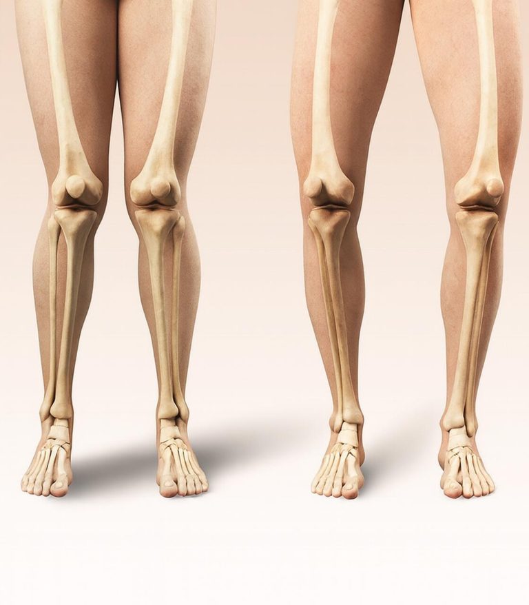 O posicionamento dos joelhos interfere diretamente na biomecânica do corpo.