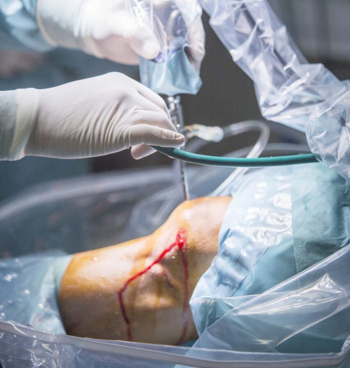 Sutura do menisco quando ela é indicada